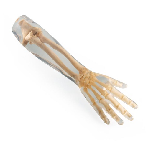 [24708-01] ERLERZIMMER X-Ray Phantom Forearm, transparent
