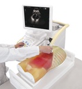 ERLERZIMMER FAST Ultrasound Examination Model
