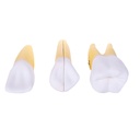 HEINESCIENTIFIC Zerlegbares Zahnmodell, 3er-Set