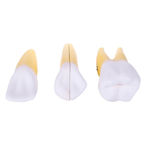 [24954-01] HEINESCIENTIFIC Dismountable tooth model, 3-piece set