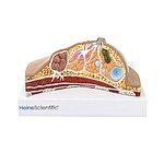 HEINESCIENTIFIC Breast model with diseases