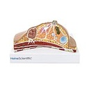 HEINESCIENTIFIC Breast model with diseases