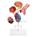 HEINESCIENTIFIC Model of hypertension consequences