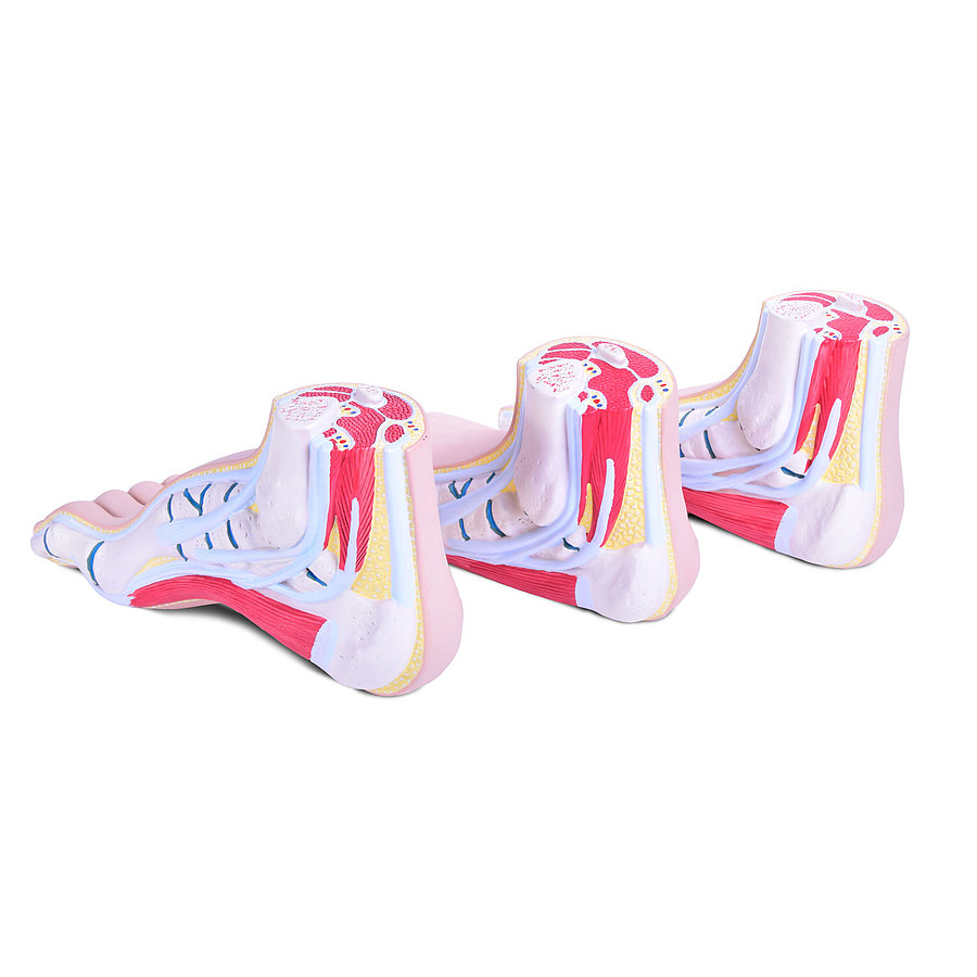 HEINESCIENTIFIC Foot deformity model