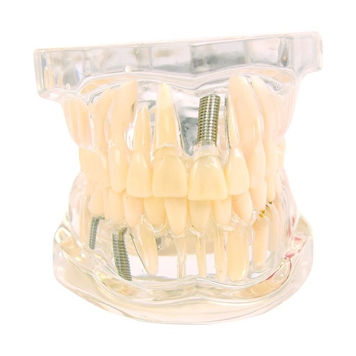 [27076-01] HEINESCIENTIFIC Transparent jaw model / Adult dentition