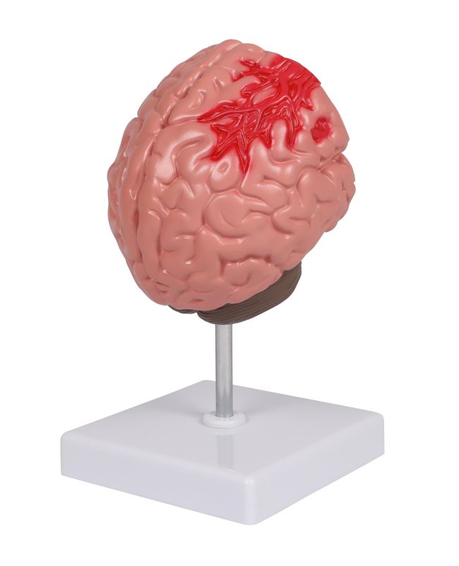 ERLERZIMMER Pathologies of the Brain, life-size