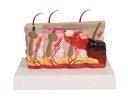 ERLERZIMMER Pathological Skin Model with Burn, 30-times size