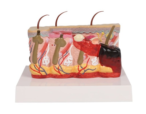 [27396-01] ERLERZIMMER Pathologisches Hautmodell mit Verbrennung, 30-fache Größe