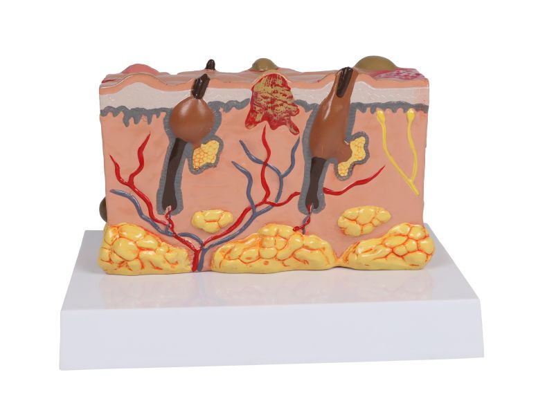 ERLERZIMMER Pathological Skin Model