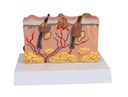ERLERZIMMER Pathological Skin Model