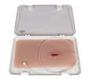 ERLERZIMMER Wundmoulage Stichwunde mit Blutungsfunktion