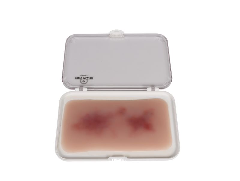 ERLERZIMMER Wound Moulage Hematoma Fresh