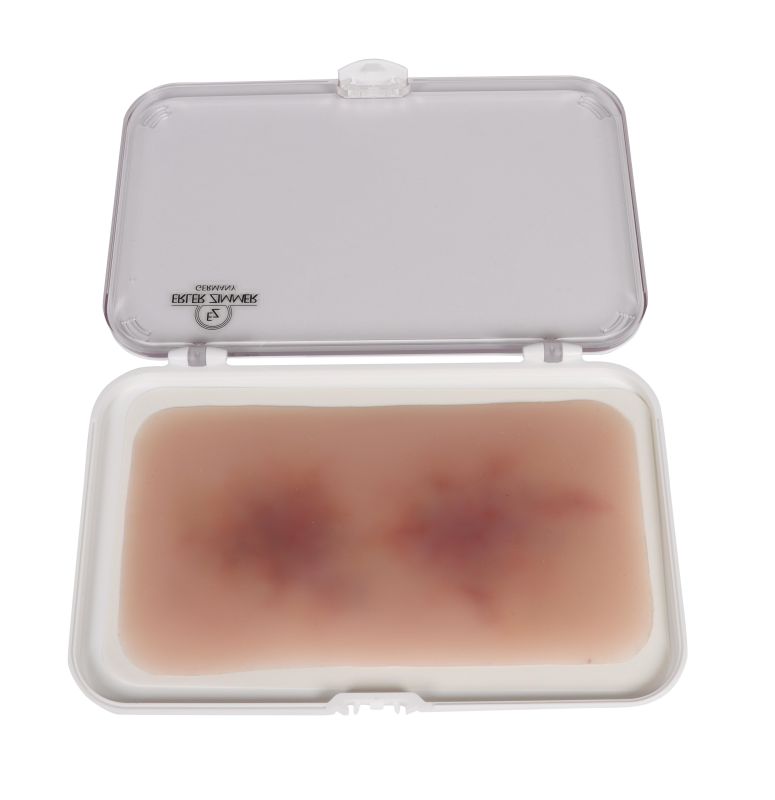 ERLERZIMMER Wound Moulage Hematoma Older