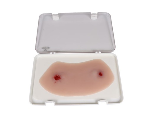 [27409-01] ERLERZIMMER Wound Moulage Gunshot Ankle Joint