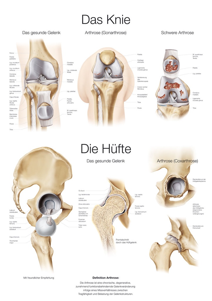 ERLERZIMMER Anatomical Chart The Knee and The Hip