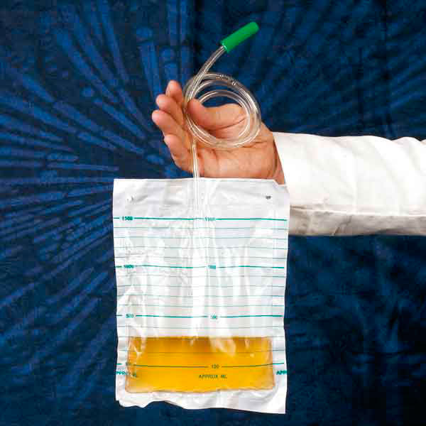 DCT Urine Bag 1.5 l for bed attachment without non-return valve