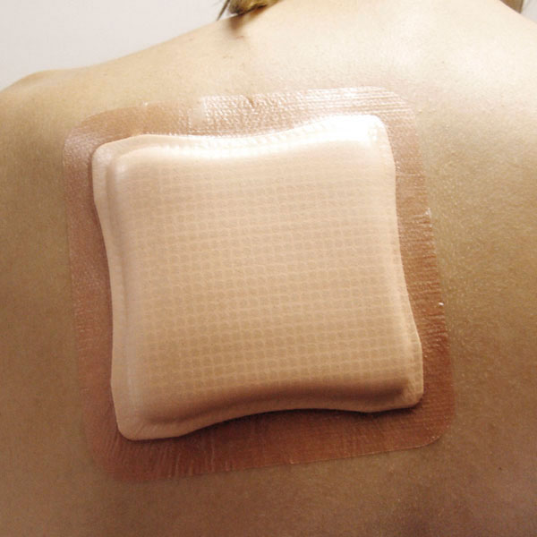 SMITH&NEPHEW Allevyn Foam dressing adhesive